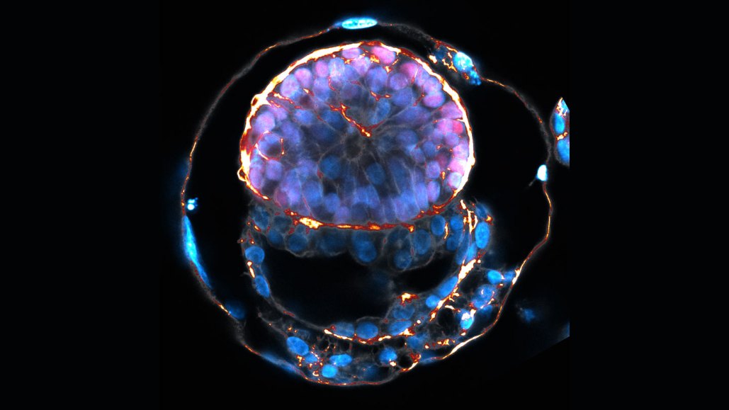 A model of a human embryo against a black backdrop. The model has ane exterior ring dotted with bluish light clumps. Wtihin is an oval-shaped purplish blob of cells with orange running through it. Below that are long bluish structures, also with bright orange and white running between cells