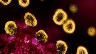 An image of HIV particles seen in yellow replicating from an infected T cell seen in pink.
