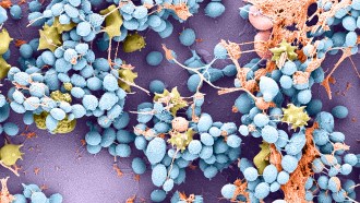 A magnified image of Candida auris, seen in blue, while nearby immune cells are seen in yellow.